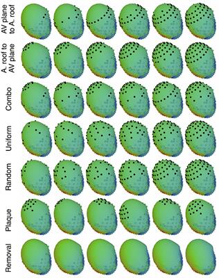 Reducing Error in ECG Forward Simulations With Improved Source Sampling